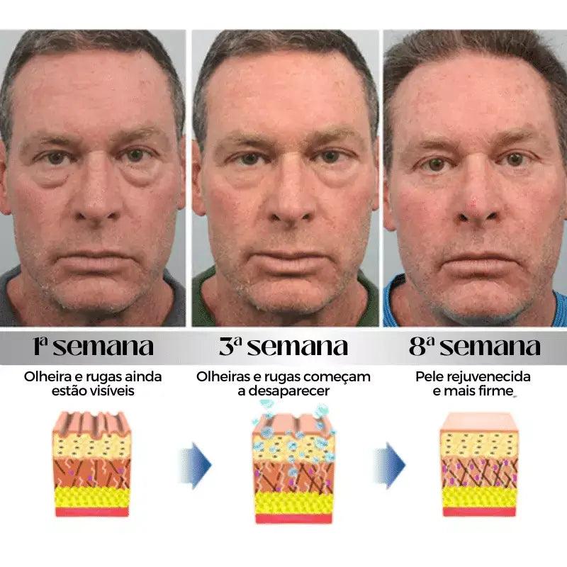 Crema para Ojeras Profundas y Oscuras