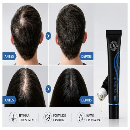 Repair Hair® - Crecimiento Capilar y Combate la Caída del Cabello