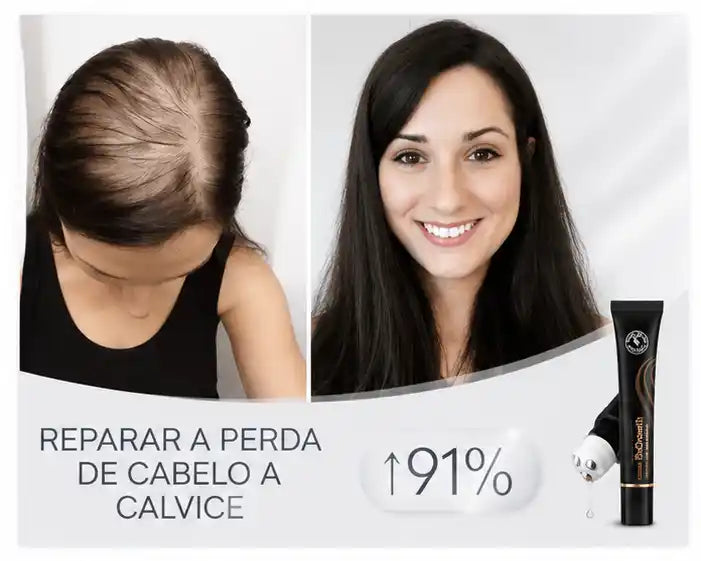 Repair Hair® - Crecimiento Capilar y Combate la Caída del Cabello