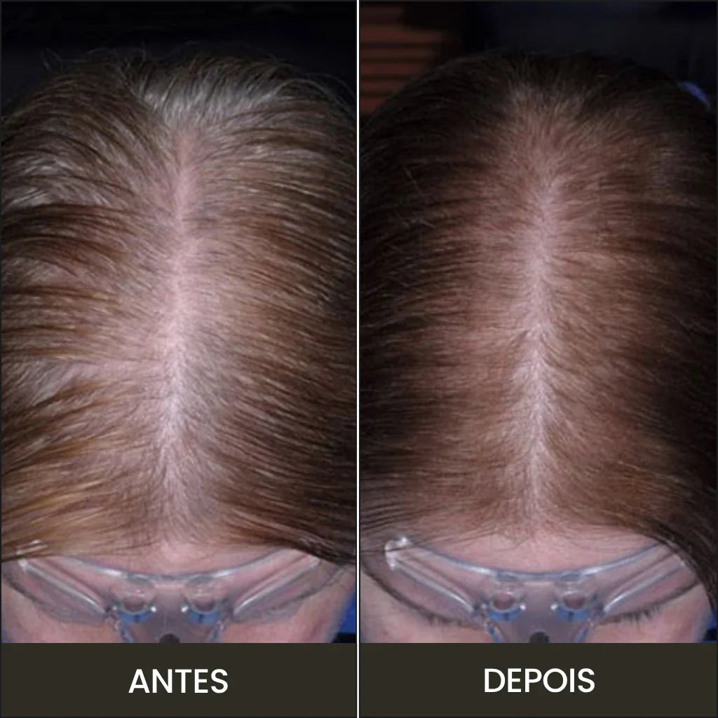 Peine BreoBrush: Terapia de Luz, Masajeador y Difusor
