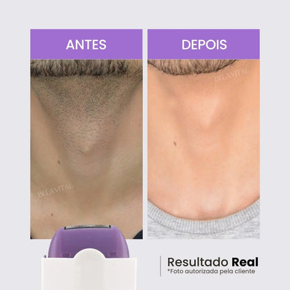 Depilador Láser Flex Indoloro + Regalo