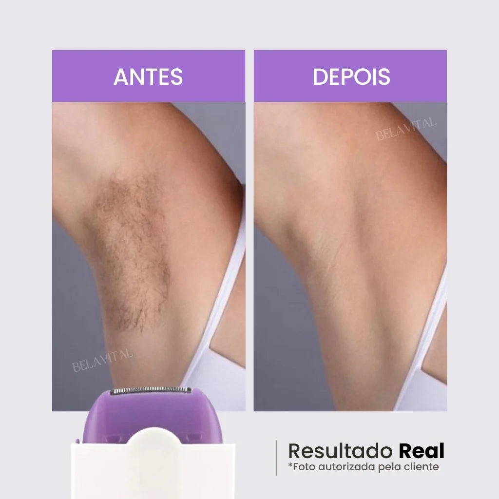 Depilador Láser Flex Indoloro + Regalo